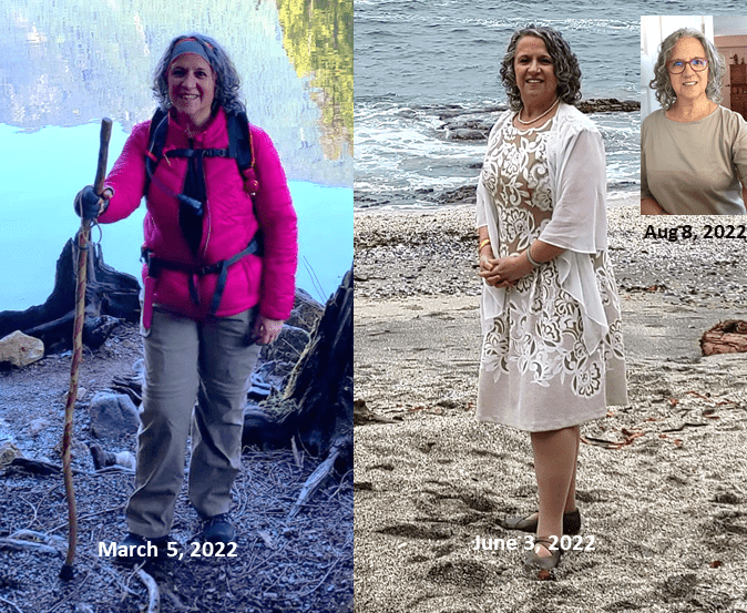 Visual timeline of hypothyroidism progression