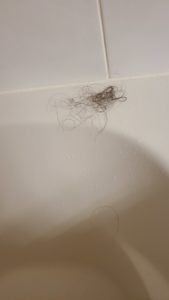 Clinical hair observation