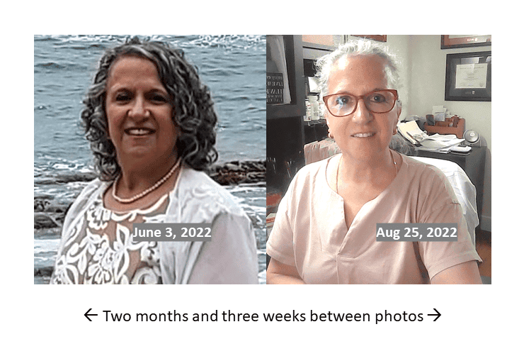 From profound hypothyroidism to almost 3 months on thyroid medication