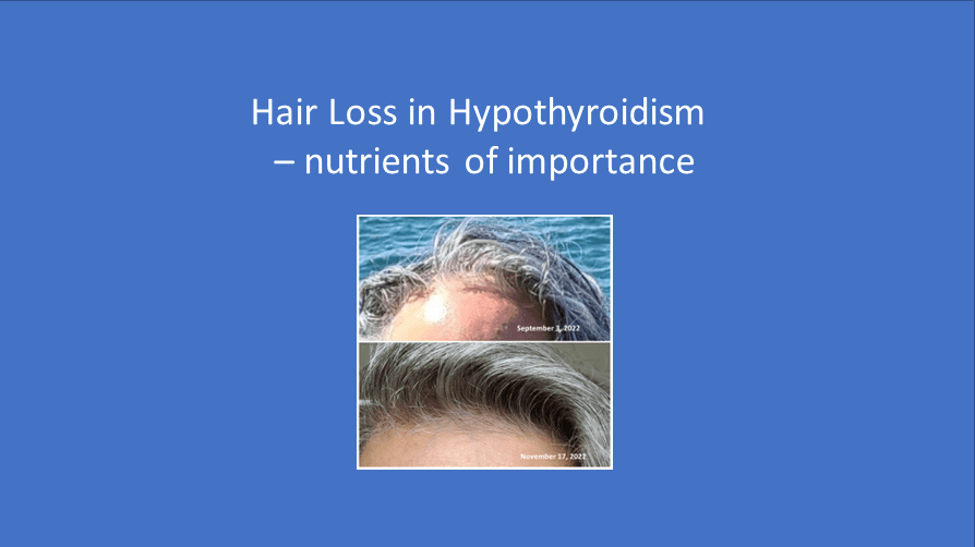 Hair Loss in Hypothyroidism nutrients of importance