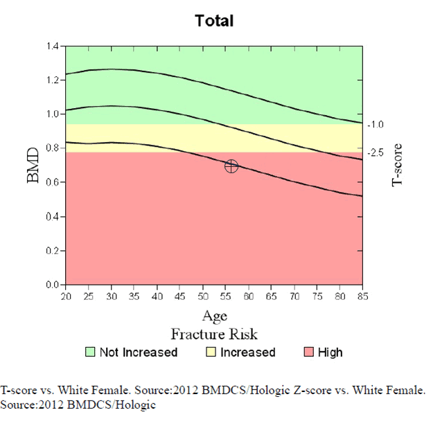 Estimated Bone Mineral Density