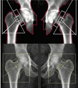 Bone density images clinical versus retail