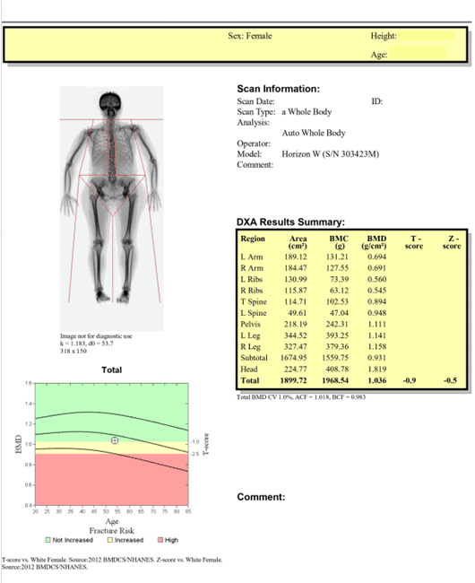 Estimation of Bone Mineral Content