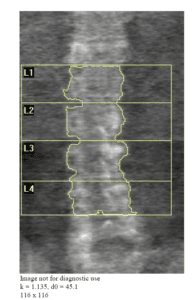Retail spinal image comparison